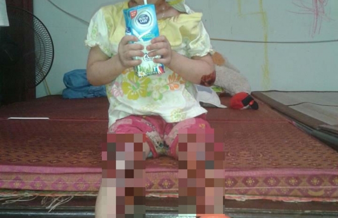 Vì sao bé Tâm Anh chùa Bồ Đề không được đưa đi chữa bệnh?